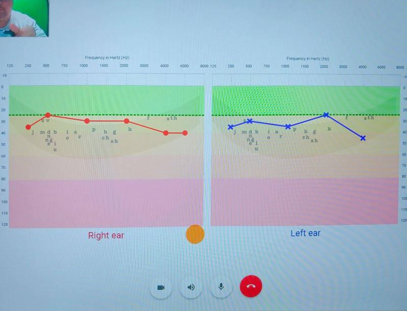 hearing test graph of results